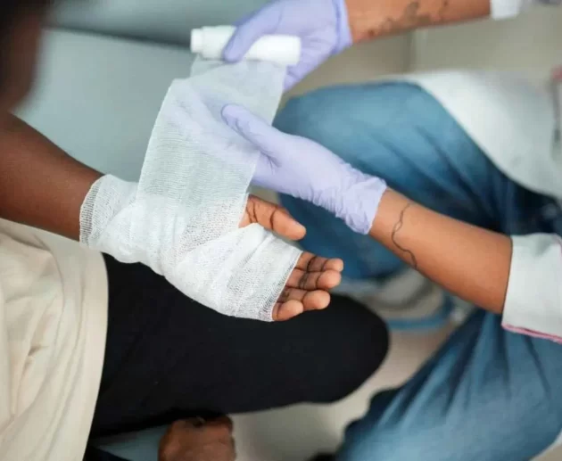 Burn injury
